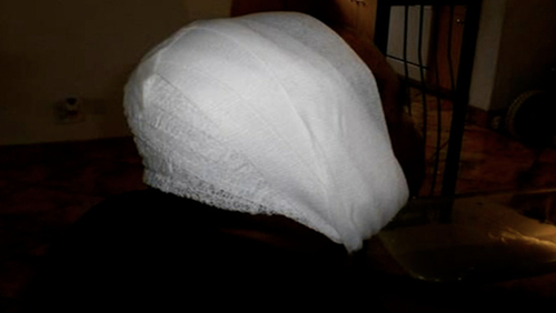 The man's bandaged head after the attack.  