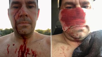 James Taylor was in the water at Mullaloo Beach in Perth's north yesterday afternoon when he felt a searing pain on his face.