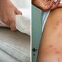 The bed bug check everyone should learn before travelling