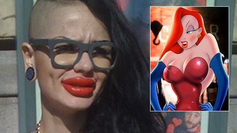 Woman undergoes 100 lip injections to look like Jessica Rabbit