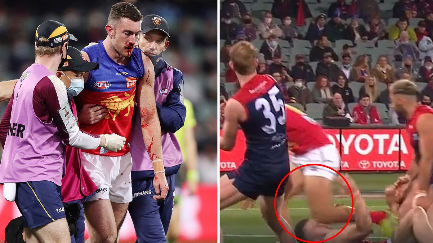 'Doesn't look good': Brisbane's Dan McStay subbed out of final against Melbourne following friendly fire 