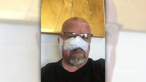 Greg Ferrington has had eight cancers removed from his head.