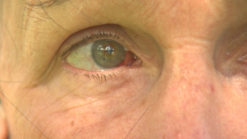 Ms McGlinchen suffered minor bruising around her eye after the incident. (9NEWS)