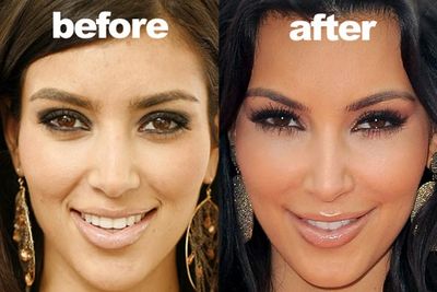 "I've tried Botox before," Kim has said of her cosmetic adventures. "That's the only thing that I've done. I've never had my nose done."