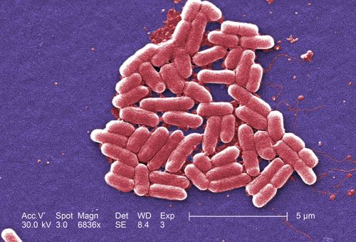 E-Coli bacteria as seen under a microscope.
