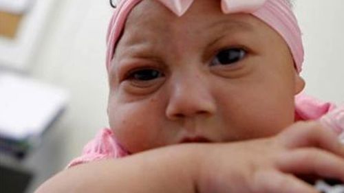 Zika has been linked to microcephaly. (AAP file image)