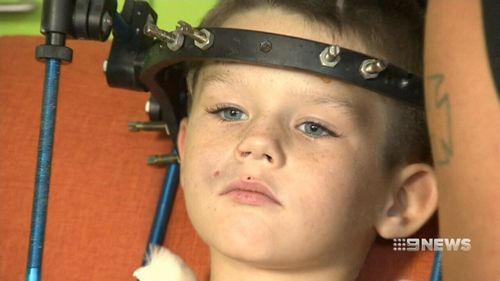 The brave five-year-old will have to wear a halo brace for some time to come. (9NEWS)
