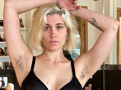 Lea Combres knew the reason she wasn't booking modelling jobs was because of her body hair.