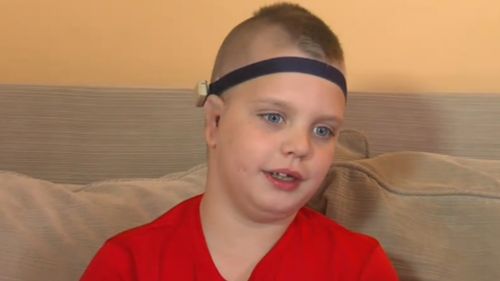 Boy born without ears gets new pair with rare surgery