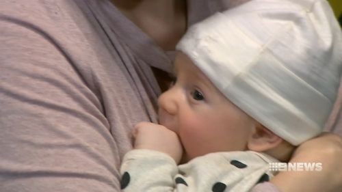 There has been an increased number of babies with the condition of 'plagiocephaly' which causes "flat spots". Picture: 9NEWS