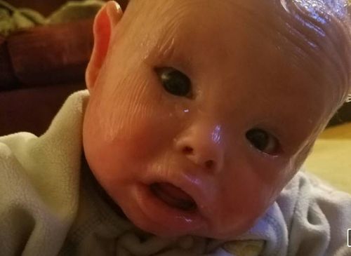 ‘He came out crying and I knew he was going to fight': Mum bathes baby in bleach to beat rare skin condition