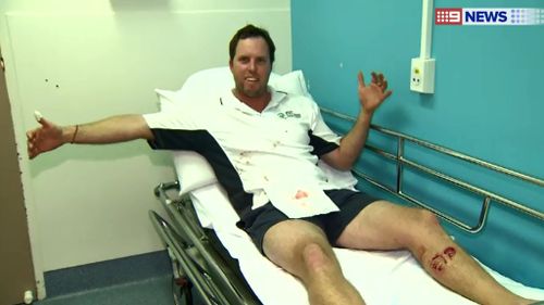 Mr van Burck said he was bitten by a one-metre reef shark. (9NEWS)