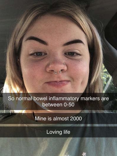 Amelie was relieved and scared when she finally found out she had Crohn's disease.