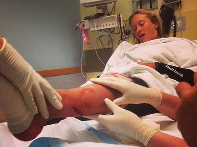 Kirra-Belle Olsson in hospital being treated for her injuries after the shark attack.