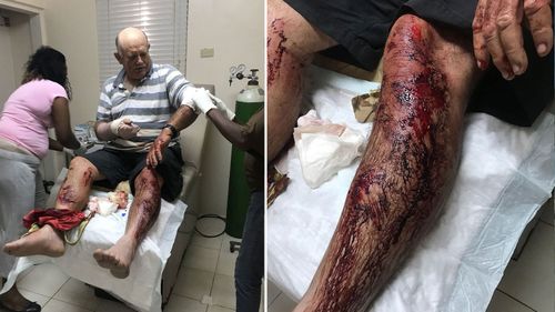 Stephen Higgs suffered serious lacerations to his arms and legs. (Bahamas Post)