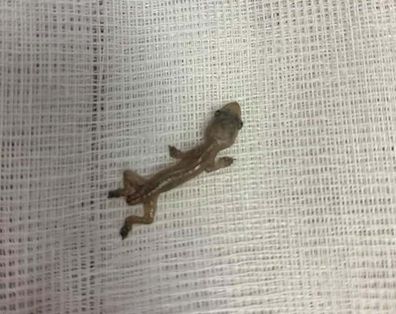 Dr Varanya Nganthavee found a gecko lodged in a patient's ear during a shift at a Thai hospital.