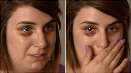 Rita Iliopoulos was brutally assaulted in full view of the public, suffering a broken nose, swelling and bruising. (9NEWS)