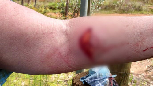 Pam Baldwin sustained a deep gash when a kangaroo attacked her at Nail Can Hill.