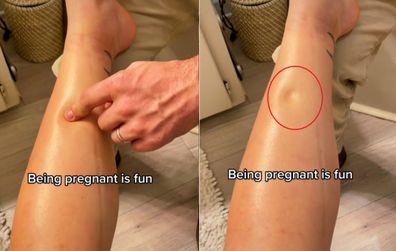 Pregnant woman on TikTok shows bizarre pregnancy symptom. 