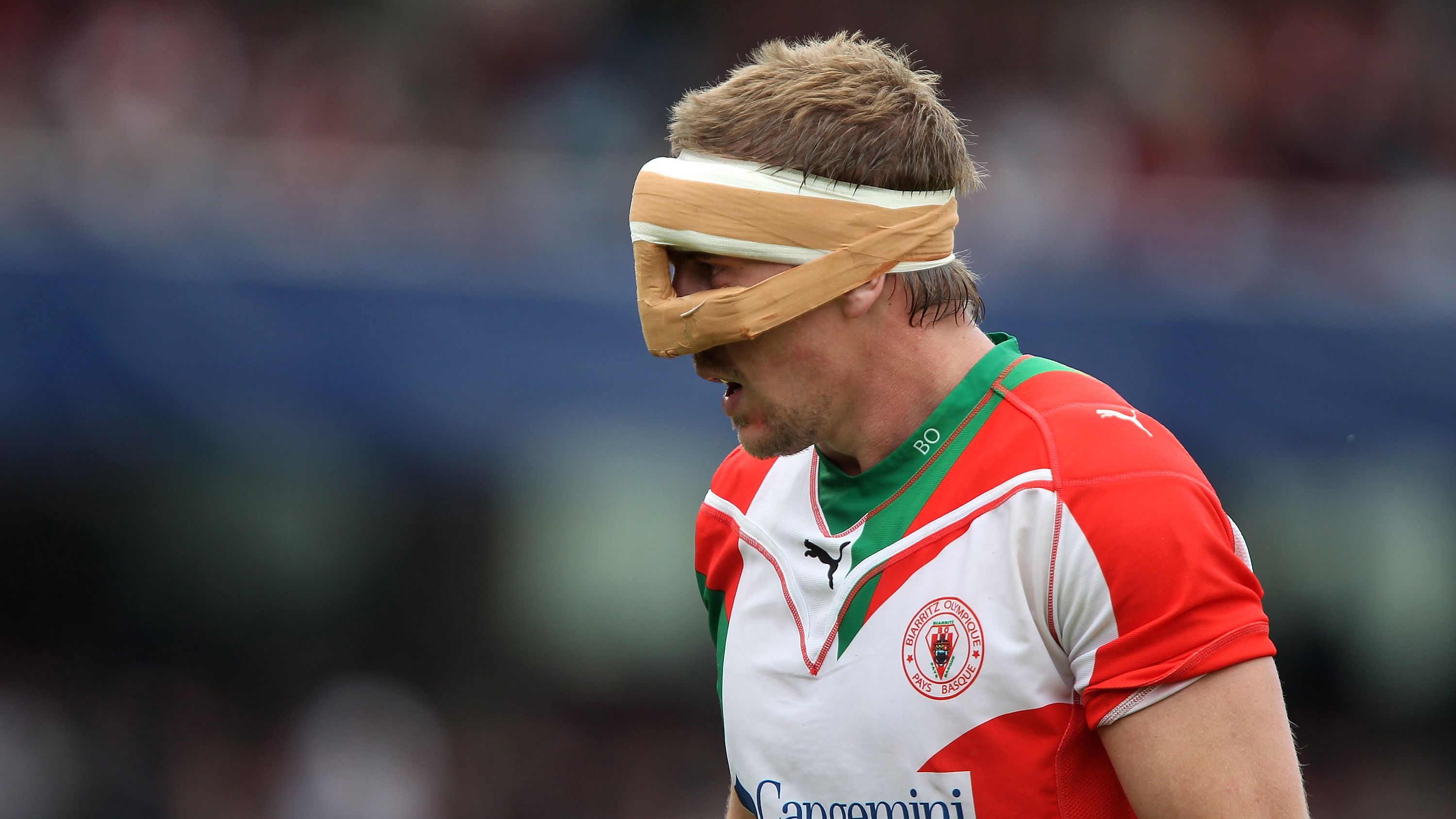 Imanol Harinordoquy of Biarritz wears a face protector in 2010.