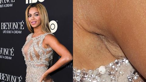 Whoops! Beyonce forgets to shave armpits for premiere, still looks amazing
