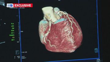 An elusive but deadly form of cholesterol could increase the risk of multiple heart attacks in older Aussies, a study has found.