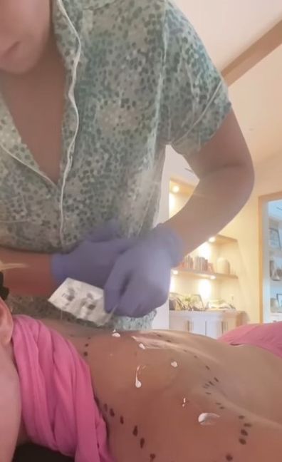 Teddi Mellencamp daughter Slate applies her immunotherapy cream.