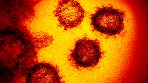 Das neuartige Coronavirus SARS-CoV-2 – auch bekannt als 2019-nCoV – wird unter einem Mikroskop gezeigt.  Das Virus verursacht COVID-19. 