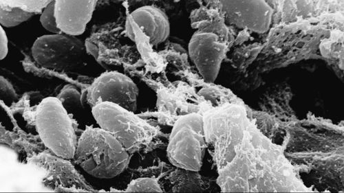 An electron micrograph depicting a mass of Yersinia pestis bacteria, the cause of bubonic plague. (AP Photo/Rocky Mountain Laboratories)