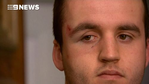 Three men were assaulted at the Coogee party. (9NEWS)