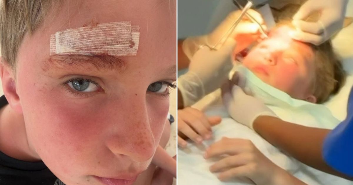 Alec and Hilaria Baldwin end up in hospital after son ‘splits head open’ on family holiday