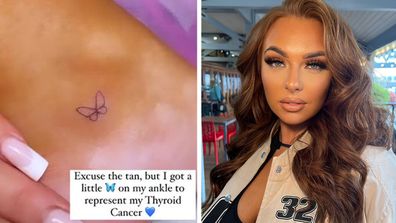 Love Island UK Demi Jones ankle tattoo cancer free