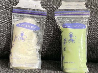 Left- white breast milk, Right- green breast milk