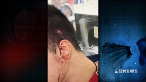 One of the teens was bashed in the head with a fishing rod. (9NEWS)