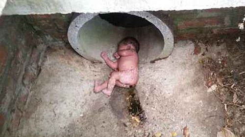 The baby was found in a drain in the South African town of Port Elizabeth last week. (Cornie Viljoen)