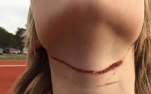 Prank leaves boy with cuts to his neck after riding his bicycle in a Ballarat park