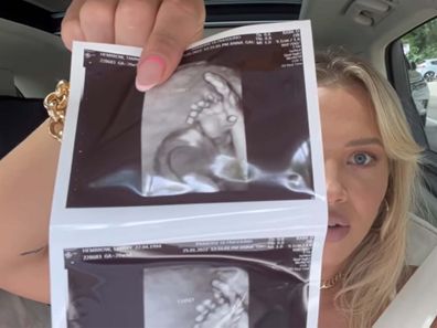 Influencer Tammy Hembrow holds up ultrasound photos.