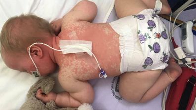 Mum's heartbreaking message to anti-vaxxers