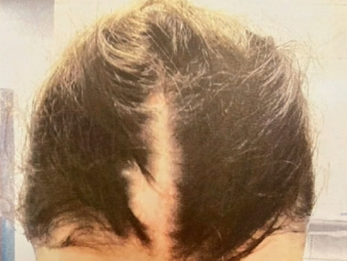 The injuries sustained by Senior Constable Anthea Beck.