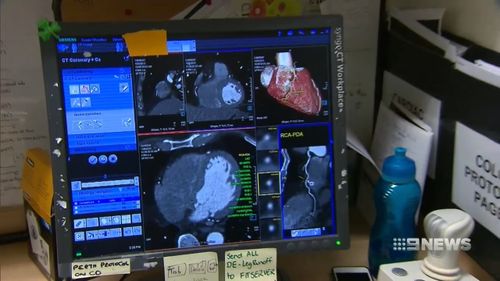 Research showed that a bigger build-up of calcium in the aorta of the abdomen led to a higher risk of cardiovascular disease. Picture: 9NEWS