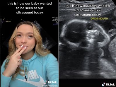 TikTok mum shows 'terrifying' baby on ultrasound. 