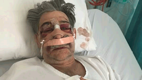 Edmund Pribitkin was almost unrecognisable after the attack. (9NEWS)