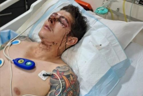 Emergency services arrived a short time later and took the 25-year-old man to hospital with non-life-threatening injuries.