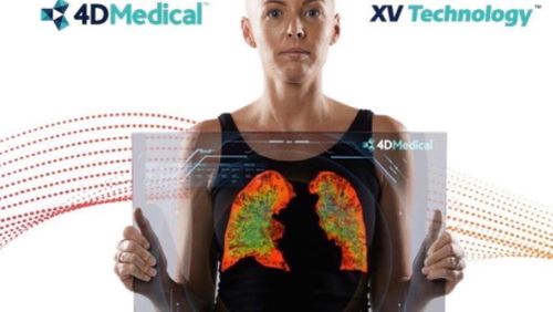 The new device, called an XV scanner, was created by medical tech firm 4DMedical, and offers a 'four dimensional' look at the lungs.