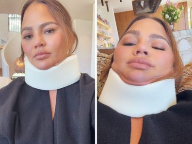 Chrissy Teigen selfie wearing neck brace