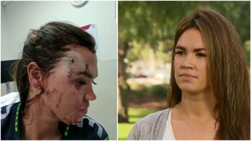 Jessica Hardiman was glassed at a Geelong pub in November last year. (9NEWS)