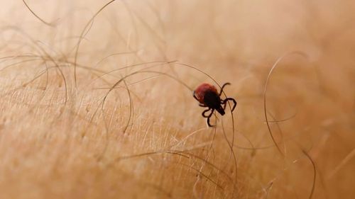 As ticks are very small and their bites do not usually hurt, ticks can easily be overlooked on the body.