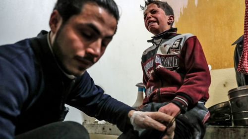 A child casualty receives treatment. (AP).