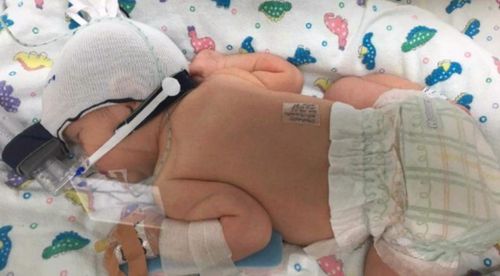 A fundraising page has been launched for baby Willa and her father Glynn. (9NEWS)