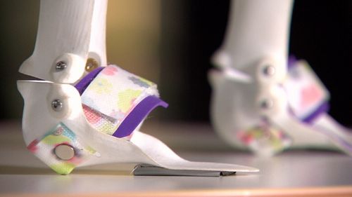 A pair of AbilityMate's Magic Shoes. (9NEWS)